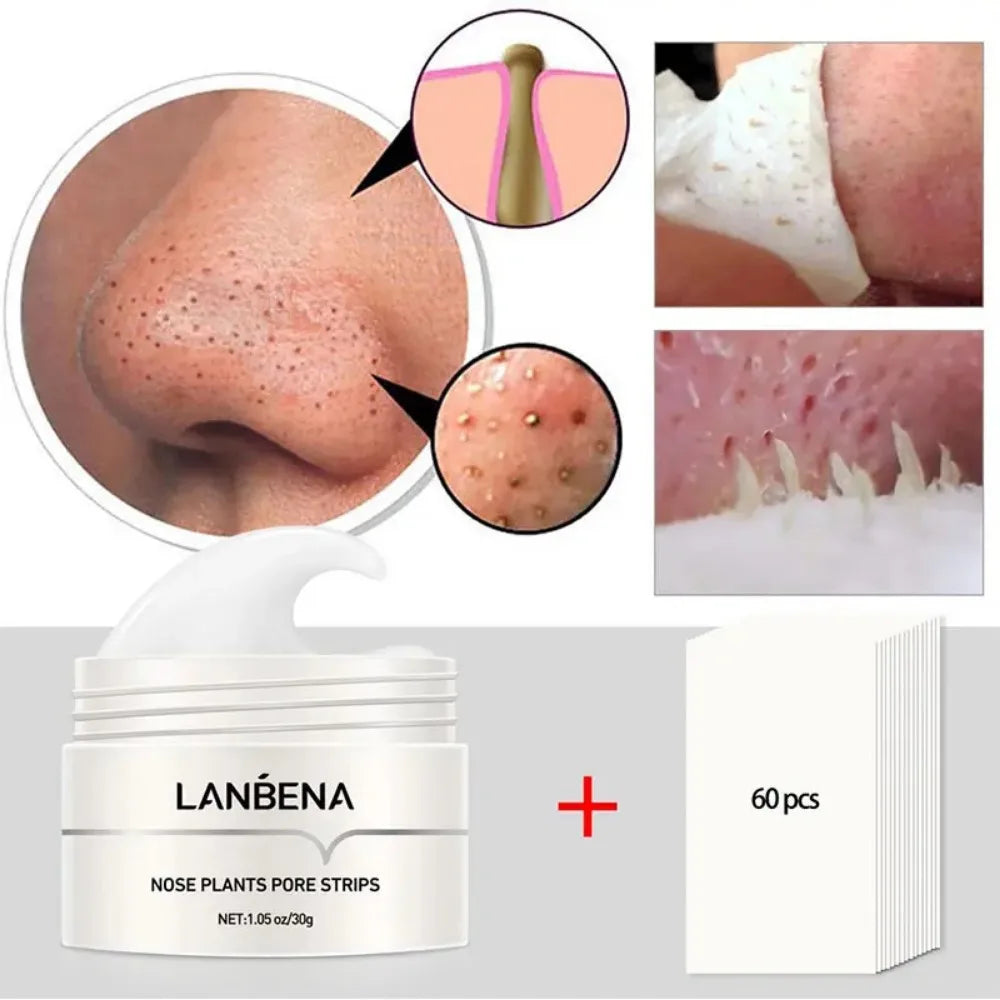Removedor de Acnes