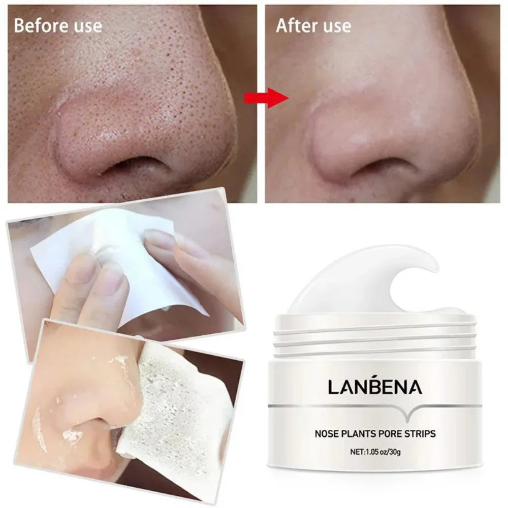 Removedor de Acnes