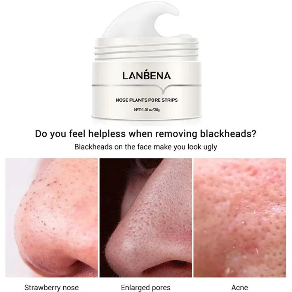 Removedor de Acnes